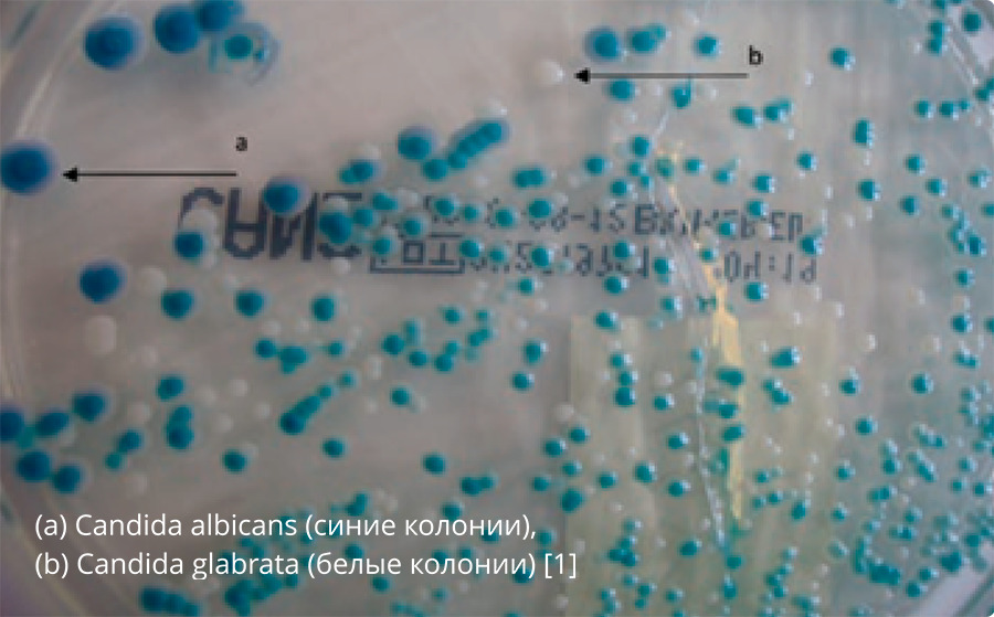 Колонии грибов Candida